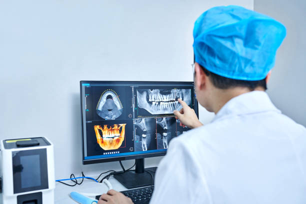 Best Emergency Dental Care for Broken or Chipped Teeth in Graham, WA